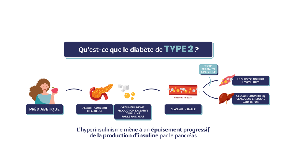 Qu’est-ce que le diabète de type 2 ? Sujet prédiabétique