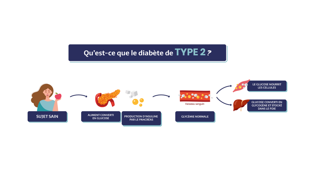 Qu’est-ce que le diabète de type 2 ? Sujet sain