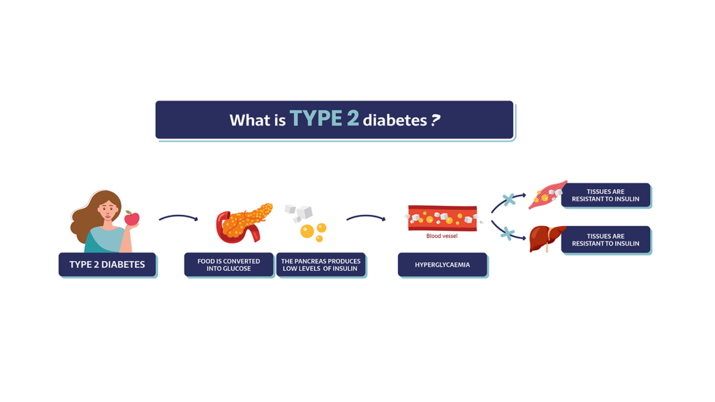 What is type 2 diabetes?