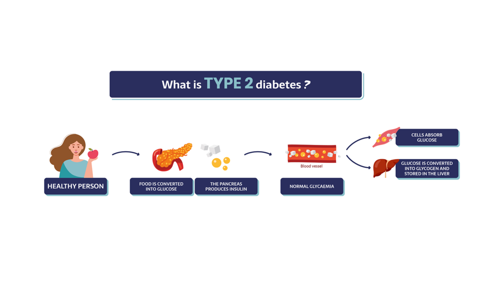 What is type 2 diabetes? Healthy state