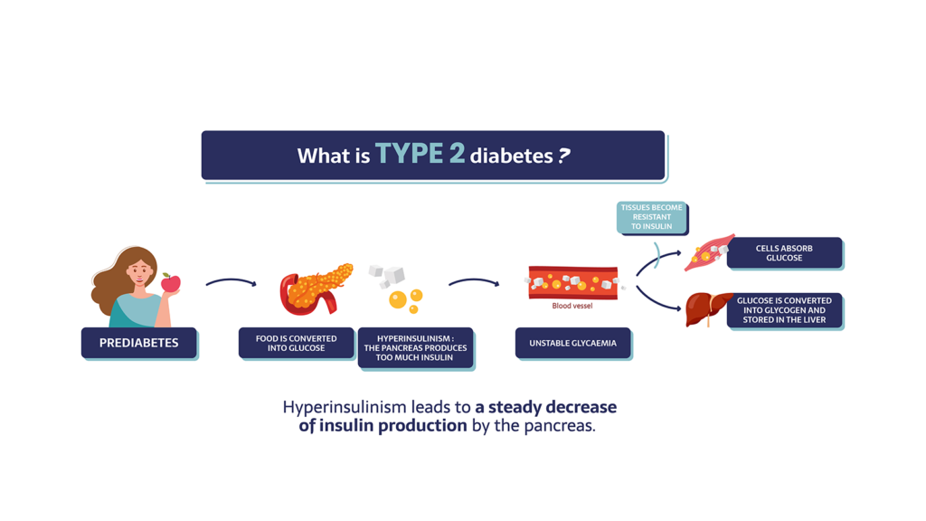What is type 2 diabetes? Prediabetes